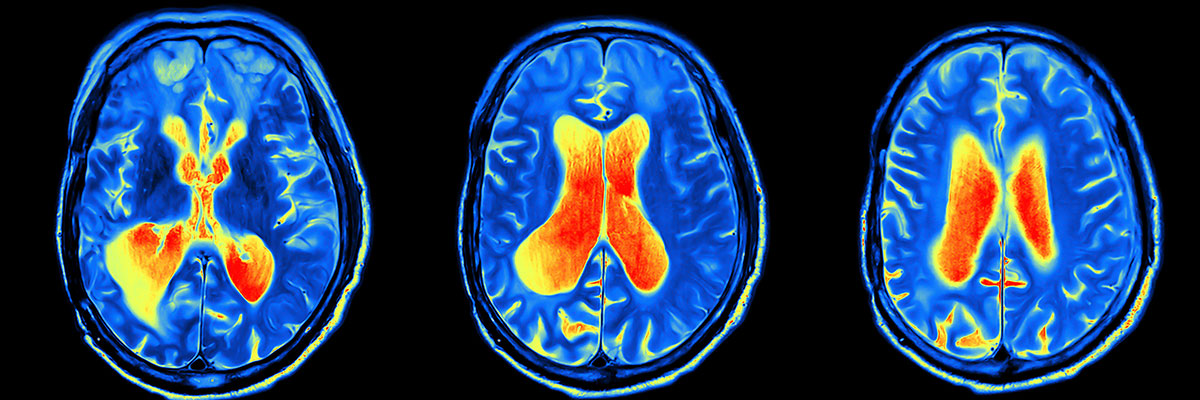 Nuclear Medicine - Services - Imaging - Radiology - Willis-Knighton