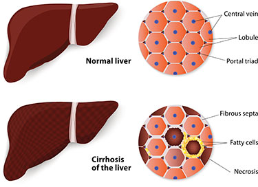 Liver Transplantation Transplantation Services John C - 