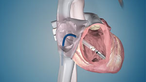 New Technology - Willis-Knighton Health System - Shreveport - Bossier