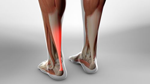 achilles-tendon-lengthening-percutaneous-method-willis-knighton