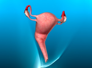 Abnormal Uterine Bleeding