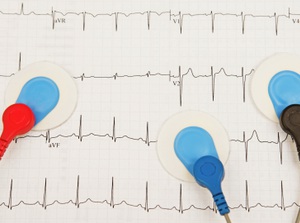 Electrocardiography (ECG, EKG) - Willis-Knighton Health System ...