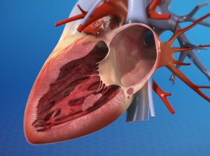 Mitral Valve Repair (Minimally-Invasive Technique)