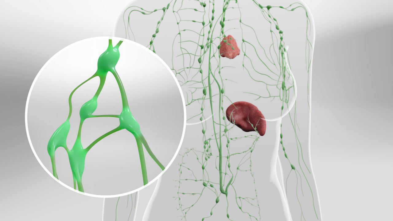 Sentinel Lymph Node Biopsy