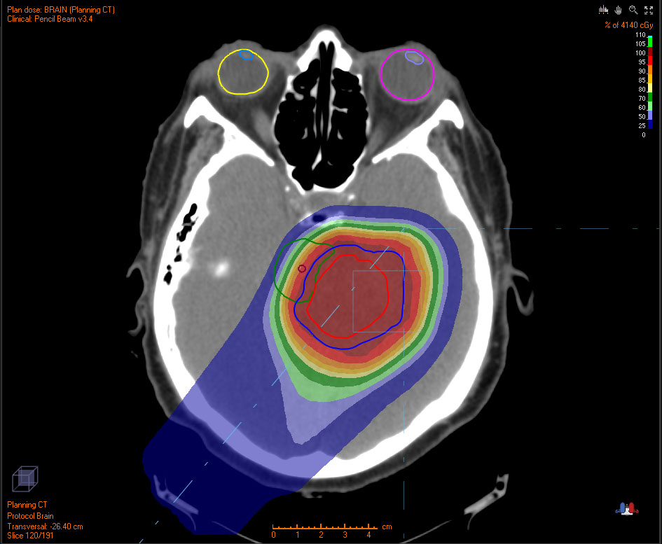 with-proton WITH PROTONS